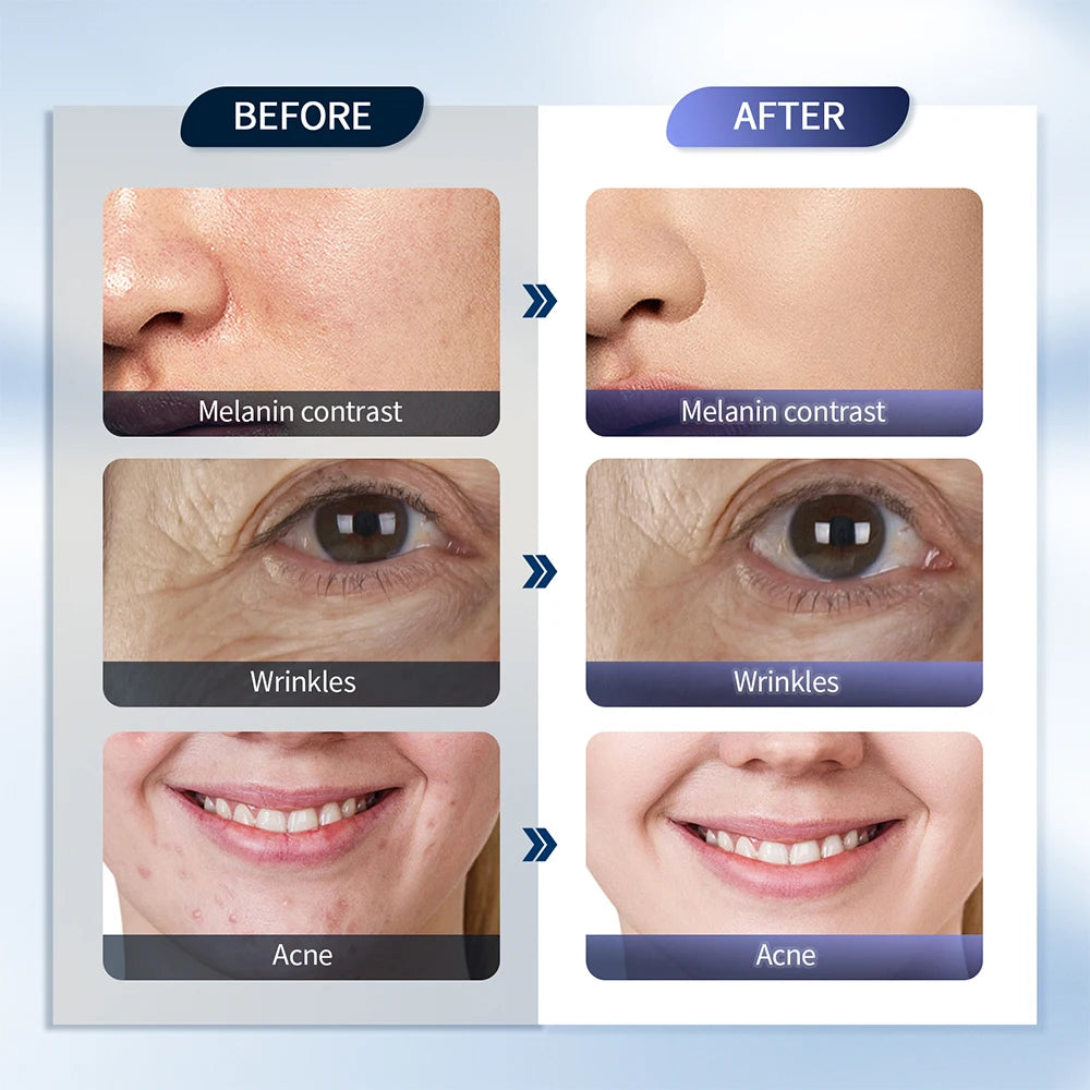 Hestia™ Facial Therapy Panel